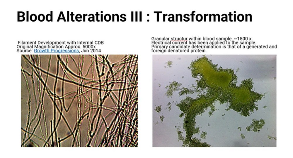 Screenshot 2022 12 30 at 16 16 05 Synthetic Biological Life Forms Cross Domain Bacteria Morgellons and Correlation to Current Live Blood Findings in Post C19 Injection Era My Conversation with Clifford Carnicom