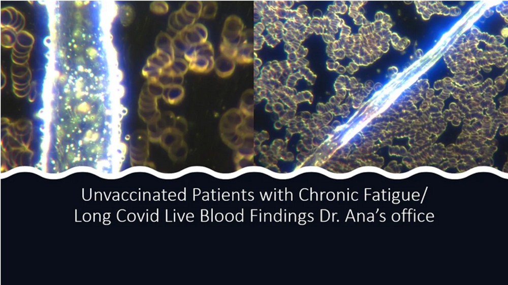 Screenshot 2022 12 30 at 16 21 48 Synthetic Biological Life Forms Cross Domain Bacteria Morgellons and Correlation to Current Live Blood Findings in Post C19 Injection Era My Conversation with Clifford Carnicom